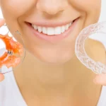 Klinika Invisalign Warszawa